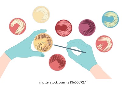 Agar plate method cell colony growth loop Bacteria Test blood stool urine mucus spinal fluid Sepsis Lab microbe fungi virus exam throat strep petri dish pour c diff germs Inoculate bacteriological