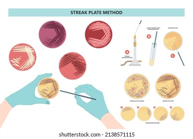 Agar Plate Method Cell Colony Growth Loop Bacteria Test Blood Stool Urine Mucus Spinal Fluid Sepsis Lab Microbe Fungi Virus Exam Throat Strep Petri Dish Pour C Diff Germs Inoculate Bacteriological