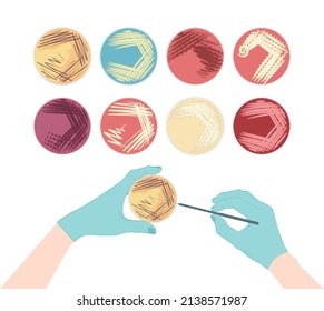 Agar Plate Method Cell Colony Growth Loop Bacteria Test Blood Stool Urine Mucus Spinal Fluid Sepsis Lab Microbe Fungi Virus Exam Throat Strep Petri Dish Pour C Diff Germs Inoculate Bacteriological