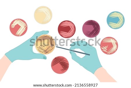 Agar plate method cell colony growth loop Bacteria Test blood stool urine mucus spinal fluid Sepsis Lab microbe fungi virus exam throat strep petri dish pour c diff germs Inoculate bacteriological