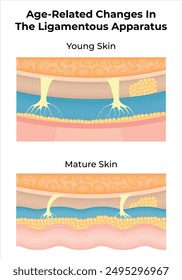 Age Related Changees in The Ligamentous Apparatus Science Design Vector Illustration Diagram