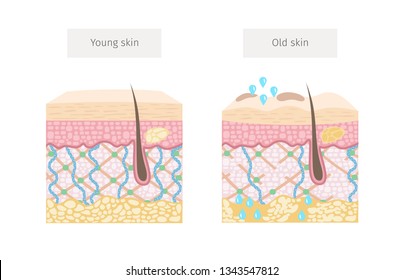 Age, Young And Old Skin, Age Changes, Collagen And Elastin Progressive, Hyaluronic Acid