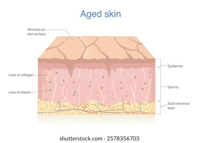 Aged skin layer isolated on white. Wrinkles and dryness on skin surface. Loss of collagen and elastin.  Skin problems in epidermis and dermis from aging.