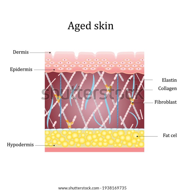 Aged skin layer.\
Structure human aged skin with collagen and elastin fibers,\
fibroblasts. Vector\
diagram