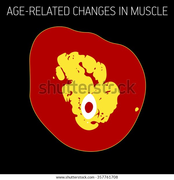 Age-related changes in\
muscle.