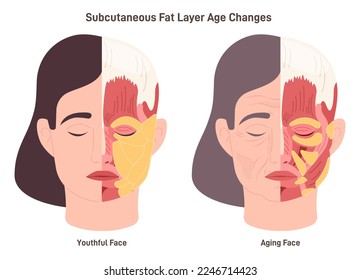 Age-related skin changes. Aging process, subcutaneous fat layer changes, woman getting wrinkles with age. Flat vector illustration