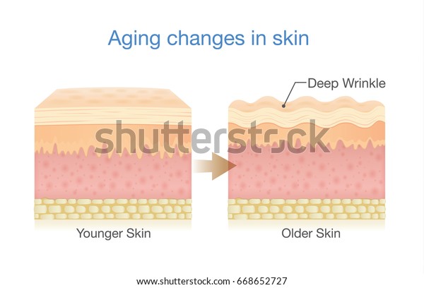 皮膚の老化の変化 医療図と医療に関するイラスト のベクター画像素材 ロイヤリティフリー