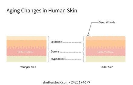 Envejecimiento Cambios en la piel más joven, más vieja. Anatomía, colágeno, elastina.  Estructura de la dermis, diagrama vectorial, ilustraciones, blanco aislado, horizontal, espacio libre, comparar 