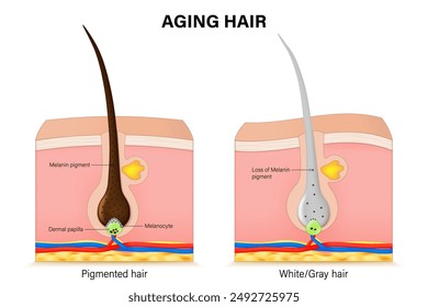 Aging hair. Pigmented and gray hair. Due to increasing age Hair becomes gray due to the loss of melanin.