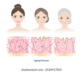 Comparación del proceso de envejecimiento con las mujeres de 3 generaciones que se enfrentan a la Ilustración vectorial. Sección transversal de alta densidad, agotamiento y baja densidad de colágeno, fibras de elastina y fibroblastos en la dermis.