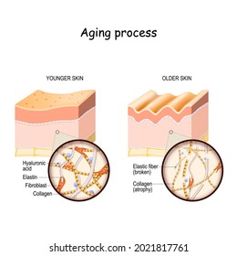 Aging process. comparison and difference between younger and older skin. Layers of the skin and close up of elastin, collagen fibers, hyaluronic acid, and fibroblast.