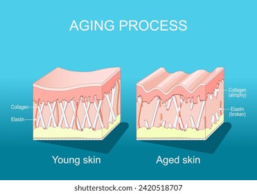 Aging process. comparison of young and aged skin. Collagen, Elastin and fibroblasts in younger and older skin. age-related changes in the skin when Collagen fibers atrophy, and Elastin broken. vector