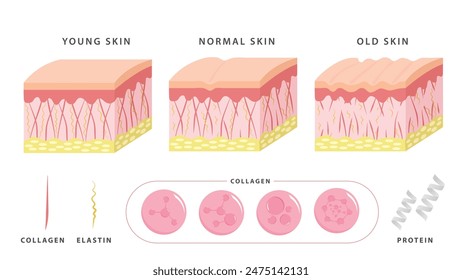 Alterungsprozess. Vergleich von junger und gealterter Haut. Kollagen, Elastin und Fibroblasten in jüngerer und älterer Vektorgrafik. 2d Abbildung. Konzept Hautpflege Kosmetiklösung.