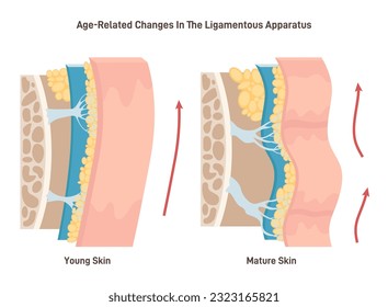 Aging process and face skin ligaments loosening. Close-up skin structure with elasticity loss on the epidermis layers. Wrinkles formation cause. Flat vector illustration