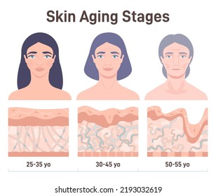 Aging process. Face skin structure changes. cross section diagram. Woman of difference ages, young, adult and old. Flat vector illustration