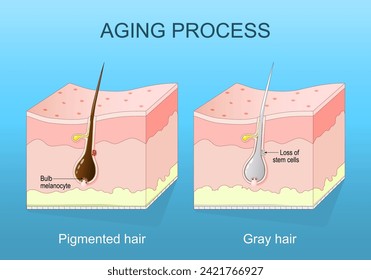 proceso de envejecimiento. Cabello en gris. Depleción de melanina y senescencia folicular del pelo. Sección transversal de una piel humana. ilustración vectorial plana isométrica