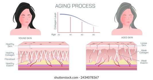 Proceso de envejecimiento de la piel. La piel envejecida se ve más delgada, pálida y clara o translúcida. En las áreas expuestas al sol pueden aparecer manchas pigmentadas, incluyendo manchas de la edad o del hígado. Cambios en colágeno y elastina.