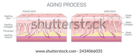 Aging process of skin. Aging skin looks thinner, paler, and clear or translucent. Pigmented spots, including age spots or liver spots may appear in sun exposed areas. Changes in collagen and elastin. Stock photo © 