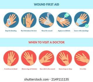 Aid skin wound. First aids stop bleeding, infographic emergency treatment damaged hands cut infected injury, steps medical dressing, pain injuries accident, neat vector illustration of medical aid