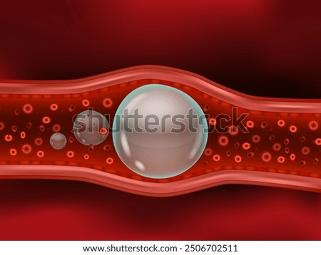 An air embolism, also called a gas embolism. Air bubbles enter a vein or artery and block it.