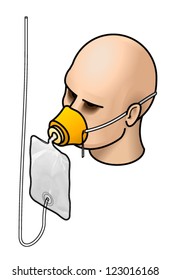 An Aircraft Emergency Oxygen Mask Fitted To A Head.