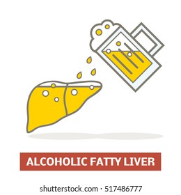 Alcoholic fatty liver concept