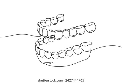 Aligners for the lower jaw. Transparent aligners for straightening teeth. World Oral Health Day. Vector illustration. Images produced without the use of any form of AI software at any stage. 