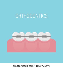 Alignment of teeth with braces. Poster with teeth in braces. Simple white healthy teeth in a row. Orthodontic treatment. Isolated vector illustration. Flat style.