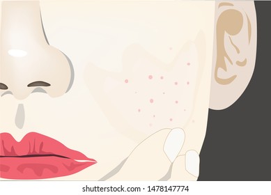 The allergic cosmetics is the cause of rash on the face.