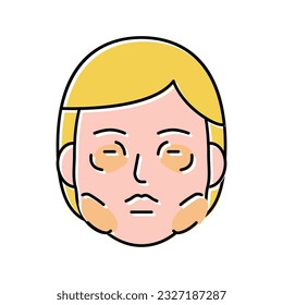 allergic edema color icon vector. allergic edema sign. isolated symbol illustration