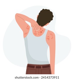 Allergic itching, skin inflammation, redness and irritation. Atopic dermatitis, eczema, psoriasis. Healthcare and medicine. Vector
