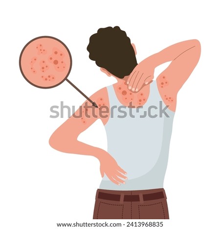 Allergic itching, skin inflammation, redness and irritation. Atopic dermatitis, eczema, psoriasis. Healthcare and medicine. Vector