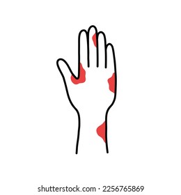 allergische Reaktion doodle Symbol, Vektorgrafik
