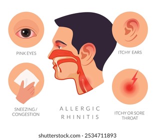 Sintomas de rinite alérgica - Espirros - Garganta prurigante - Ilustração de stock como arquivo EPS 10