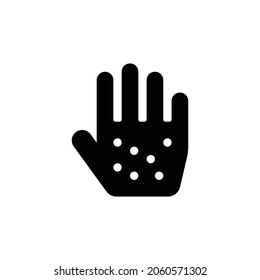 allergies Icon. Flat style design isolated on white background. Vector illustration