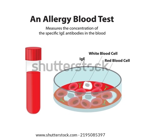 An allergy blood test, IgE test