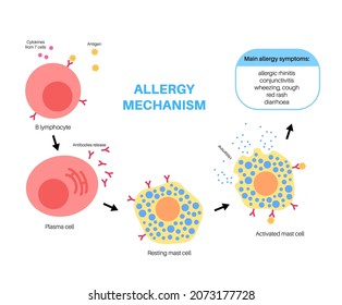 Allergy mechanism diagram. Allergic diseases concept. Immunoglobulin E antibodies in the human immune system. Binding to an allergen and to a receptor on mast cells medical flat vector illustration.