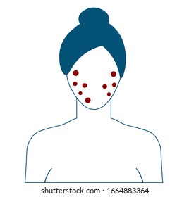 Allergy symptoms line color icon. Skin rash. Dermatological diseases. Itchy spots on face. Sign for web page, mobile app, button, logo. Vector isolated element. 