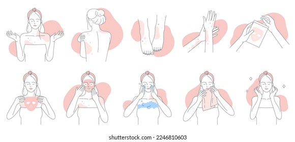 Allergy, symptoms and treatment line icons set vector illustration. Hand drawn girls suffer from allergic dermatitis and skin atopy, apply facial mask to care itchy sensitive skin with irritation