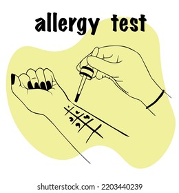 allergy test. doctor in glove holds pipette in his hand for analysis. hand patient's palm up with drops of allergens, conducts skin allergy test. patient with an allergic reaction. for medical website