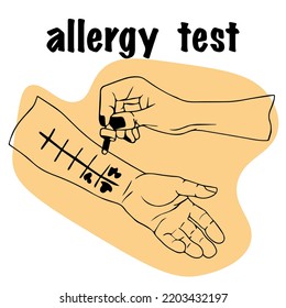 allergy test. The doctor holds pipette in his hand for examination. hand palm up, conducting skin allergy test. for medical website, advertising medicines. patient with an allergic reaction.