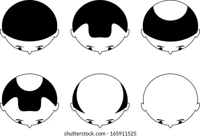 alopecia
