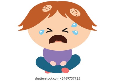 Alopecia areata is an autoimmune condition causing patchy hair loss on the scalp, face, and body ,the immune system attacks hair follicles, leading to sudden, unpredictable bald spots.