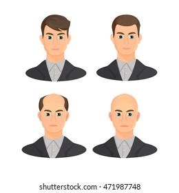 Alopecia concept. Set of heads showing the hairloss progress. Vector flat illustration.