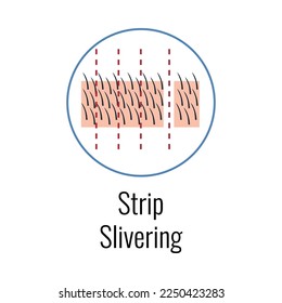 Alopecia hair transplantation composition with infographic image of hair restoration procedures with text vector illustration