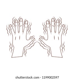 Alzheimer shaking hands