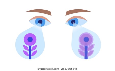 Amblyopia or lazy eye disease. Eyesight check up in the ophthalmology center. Optometry exam concept. Vision diseases, diagnostic and treatment. Human vision problem correction vector illustration