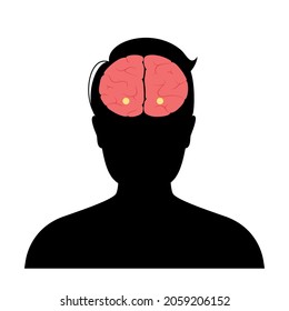 Amygdala and limbic system concept. Human brain anatomy in male silhouette. Cerebral cortex and cerebrum medical poster flat vector illustration for clinic or education.