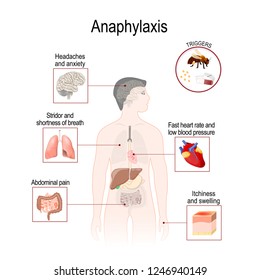 Anaphylaxis is a serious allergic reaction that may cause death. Human silhouette with highlighted internal organs. Vector illustration for medical, biological, and educational use