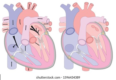 Anatomical drawing of the heart in a section. Background for medical exams, brochures, booklets, flyers. Visual aid for the study of human anatomy.